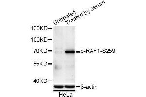Western blot analysis of extracts of NIH/3T3 and HeLa cells, using Phospho-RAF1-S259 antibody (ABIN5996185) at 1/1000 dilution. (RAF1 Antikörper  (pSer259))