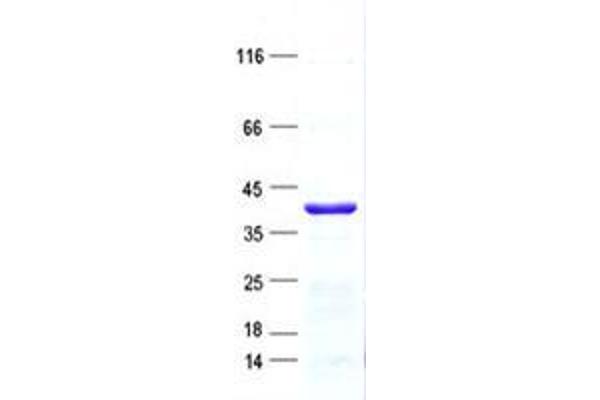 ZNF396 Protein (His tag)