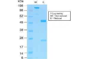 SDS-PAGE (SDS) image for anti-Nerve Growth Factor Receptor (NGFR) antibody (ABIN6940197)