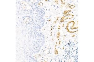 Immunohistochemistry of paraffin-embedded human colon using Decorin Rabbit pAb (ABIN3022360, ABIN3022361, ABIN3022362, ABIN1512816 and ABIN6218761) at dilution of 1:50 (40x lens). (Decorin Antikörper  (AA 31-359))