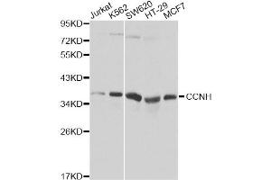 Western blot analysis of extracts of various cell lines, using CCNH Antibody (ABIN5970383). (Cyclin H Antikörper)