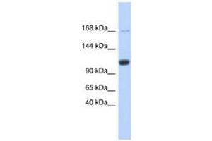 Image no. 1 for anti-U2-Associated SR140 Protein (SR140) (AA 755-804) antibody (ABIN6740720) (SR140 Antikörper  (AA 755-804))