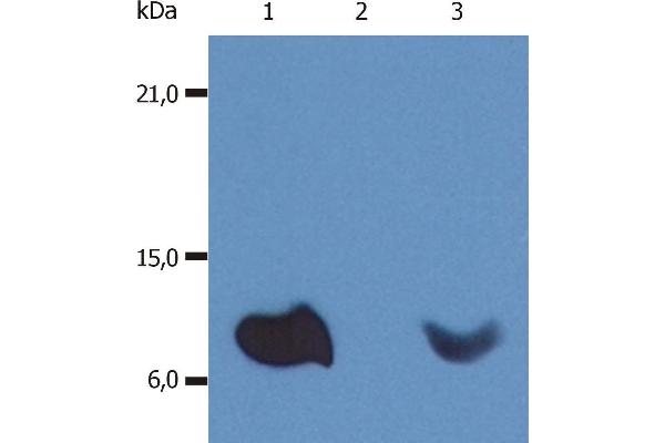 beta-2 Microglobulin Antikörper