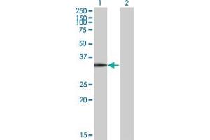 Western Blot analysis of CDK4 expression in transfected 293T cell line by CDK4 MaxPab polyclonal antibody. (CDK4 Antikörper  (AA 1-303))