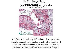 Image no. 1 for anti-Actin, beta (ACTB) (AA 359-368) antibody (ABIN1732309) (beta Actin Antikörper  (AA 359-368))