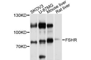 Western blot analysis of extracts of various cell lines, using FSHR antibody (ABIN5970692) at 1/1000 dilution. (FSHR Antikörper)