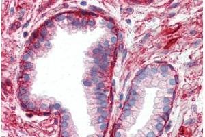 Human Prostate (formalin-fixed, paraffin-embedded) stained with ITGB1 antibody ABIN364254 at 10 ug/ml followed by biotinylated anti-mouse IgG secondary antibody ABIN481714, alkaline phosphatase-streptavidin and chromogen. (ITGB1 Antikörper)