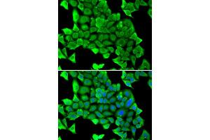 Immunofluorescence analysis of U20S cell using MYH1 antibody. (MYH1 Antikörper)