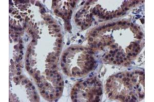 Immunohistochemistry (IHC) image for anti-Coiled-Coil-Helix-Coiled-Coil-Helix Domain Containing 5 (CHCHD5) (AA 1-110) antibody (ABIN1490561) (CHCHD5 Antikörper  (AA 1-110))