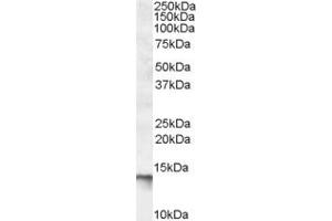 Western Blotting (WB) image for anti-C1D Nuclear Receptor Corepressor (C1D) (C-Term) antibody (ABIN2466619) (C1D Antikörper  (C-Term))