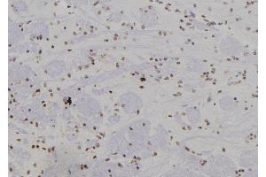 ABIN6277441 at 1/100 staining Rat brain tissue by IHC-P. (SUMO4 Antikörper)