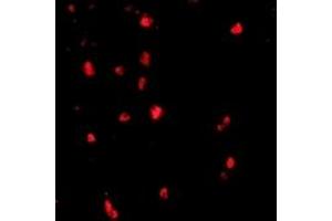 Immunofluorescence (IF) image for anti-Cas-Br-M (Murine) Ecotropic Retroviral Transforming Sequence (CBL) (C-Term) antibody (ABIN1030323) (CBL Antikörper  (C-Term))