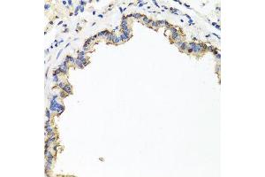 Immunohistochemistry of paraffin-embedded rat lung using CXCR4 antibody at dilution of 1:100 (x40 lens). (CXCR4 Antikörper)