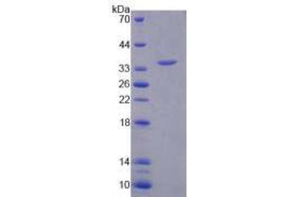 ARSF Protein (AA 23-300) (His tag)