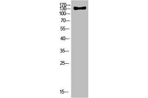 Western Blot analysis of HELA cells using Antibody diluted at 500. (ULK2 Antikörper  (AA 930-1000))