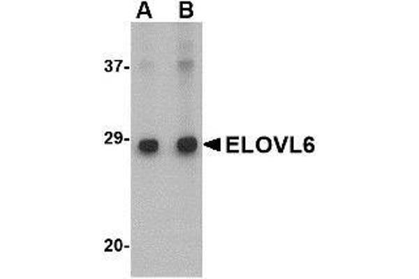 ELOVL6 Antikörper  (N-Term)