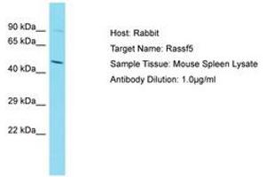 Image no. 1 for anti-Ras Association (RalGDS/AF-6) Domain Family Member 5 (RASSF5) (C-Term) antibody (ABIN6750426) (RASSF5 Antikörper  (C-Term))