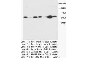 Western blot Caspase-3 (P10) Polyclonal Antibody (Caspase 3 Antikörper  (C-Term))