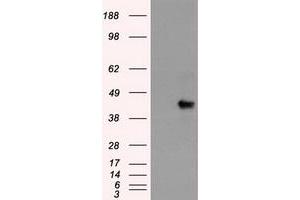 HEK293T cells were transfected with the pCMV6-ENTRY control (Left lane) or pCMV6-ENTRY SOX17 (Right lane) cDNA for 48 hrs and lysed. (SOX17 Antikörper  (AA 177-414))