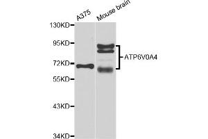 Western blot analysis of extracts of various cell lines, using ATP6V0A4 antibody (ABIN5974639) at 1/1000 dilution. (ATP6V0A4 Antikörper)
