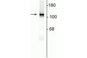 Western blot of 10 µg of rat hippocampal lysate showing specific immunolabeling of the ~120 kDa NR1 subunit of the NMDA receptor. (GRIN1/NMDAR1 Antikörper  (AA 1-564))