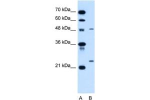Western Blotting (WB) image for anti-Sphingomyelin phosphodiesterase 2, Neutral Membrane (Neutral Sphingomyelinase) (SMPD2) antibody (ABIN2462850) (SMPD2 Antikörper)