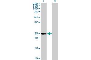 Western Blot analysis of IL6 expression in transfected 293T cell line by IL6 MaxPab polyclonal antibody. (IL-6 Antikörper  (AA 1-212))