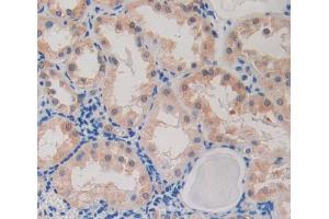 Used in DAB staining on fromalin fixed paraffin- embedded Kidney tissue (CARD9 Antikörper  (AA 26-283))