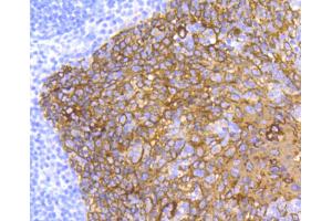 Paraformaldehyde-fixed, paraffin embedded human tonsil, Antigen retrieval by boiling in sodium citrate buffer (pH6) for 15min, Block endogenous peroxidase by 3% hydrogen peroxide for 30 minutes, Blocking buffer at 37°C for 20min, Antibody incubation with Cytokeratin 5 (2H5) Monoclonal Antibody  at 1:50 overnight at 4°C, followed by a conjugated secondary and DAB staining. (Cytokeratin 5 Antikörper)