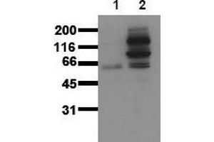 Western Blotting (WB) image for anti-Catenin (Cadherin-Associated Protein), beta 1, 88kDa (CTNNB1) (pTyr654) antibody (ABIN126742) (CTNNB1 Antikörper  (pTyr654))