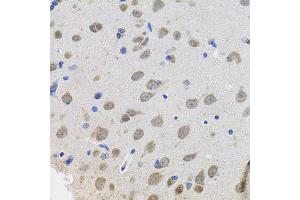 Immunohistochemistry of paraffin-embedded rat brain using VEPH1 antibody (ABIN5974616) (40x lens). (VEPH1 Antikörper)