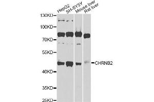 Western blot analysis of extracts of various cell lines, using CHRNB2 Antibody (ABIN6003540) at 1/1000 dilution. (CHRNB2 Antikörper)