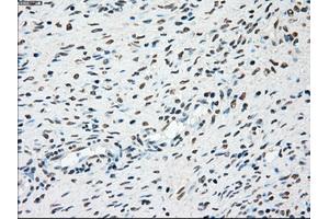 Immunohistochemical staining of paraffin-embedded colon tissue using anti-PLK1mouse monoclonal antibody. (PLK1 Antikörper)