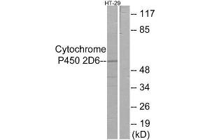 Western Blotting (WB) image for anti-Cytochrome P450, Family 2, Subfamily D, Polypeptide 6 (CYP2D6) (Internal Region) antibody (ABIN1850357) (CYP2D6 Antikörper  (Internal Region))