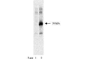 Western blot using anti-HA tag antibody  and HEK293 cells expressing HA-tagged Rem protein at 1:1000 dilution. (HA-Tag Antikörper)