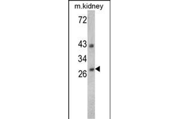 Endonuclease G Antikörper  (C-Term)