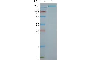 Human R1-Nanodisc, Flag Tag on SDS-PAGE (PLA2R1 Protein)