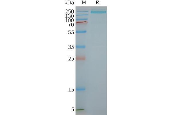 PLA2R1 Protein