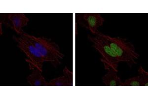 Immunofluorescence (IF) image for anti-MutS Homolog 6 (E. Coli) (MSH6) antibody (ABIN969293)