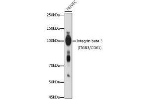 Western blot analysis of extracts of HUVEC cells, using Integrin beta 3 (ITGB3/CD61) antibody (ABIN6127572, ABIN6142584, ABIN6142586 and ABIN6219636) at 1:1000 dilution. (Integrin beta 3 Antikörper  (AA 610-718))