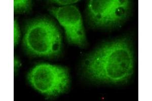 Immunocytochemistry of HeLa cells using anti-CDK5(N-terminus) mouse mAb diluted 1:150 (CDK5 Antikörper  (N-Term))