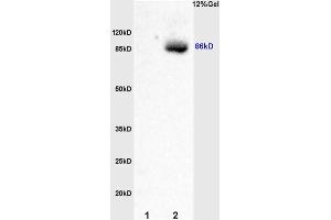 L1 rat kidney lysates L2 rat brain lysates probed with Anti Smoothened/SMO Polyclonal Antibody, Unconjugated (ABIN680908) at 1:200 overnight at 4 °C. (SMO Antikörper  (AA 551-650))