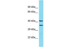 Western Blotting (WB) image for anti-Lectin, Mannose-Binding 2 (LMAN2) (N-Term) antibody (ABIN2789018) (LMAN2 Antikörper  (N-Term))