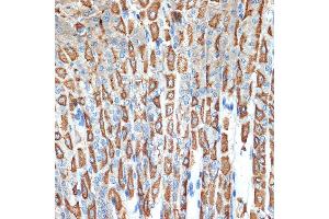 Immunohistochemistry of paraffin-embedded mouse stomach using B Rabbit mAb (ABIN7265767) at dilution of 1:100 (40x lens). (ATP4b Antikörper)