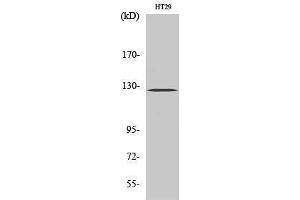 Western Blotting (WB) image for anti-PTK2 Protein tyrosine Kinase 2 (PTK2) (Thr444) antibody (ABIN3180043) (FAK Antikörper  (Thr444))