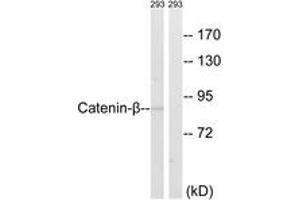 Western blot analysis of extracts from 293 cells, using Catenin-beta (Ab-489) Antibody. (beta Catenin Antikörper  (AA 455-504))