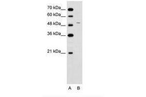 Image no. 2 for anti-Ferrochelatase (FECH) (AA 51-100) antibody (ABIN6736623) (FECH Antikörper  (AA 51-100))