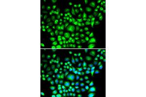 Immunofluorescence analysis of U2OS cells using BCAP31 antibody (ABIN5974244). (BCAP31 Antikörper)