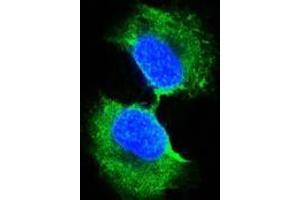 Confocal immunofluorescence analysis of PC-3 cells using GSTP1 antibody (green). (GSTP1 Antikörper)