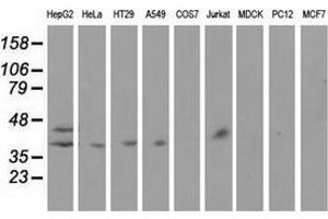 Western blot analysis of extracts (35 µg) from 9 different cell lines by using anti-HP monoclonal antibody. (Haptoglobin Antikörper)